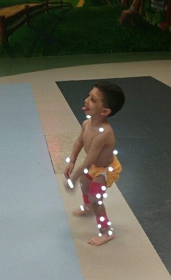 Gait Lab, AI Duppont Hospital, Delaware