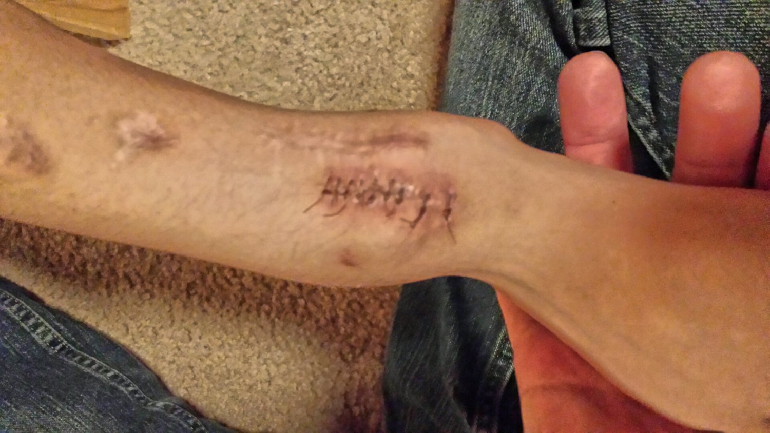 The bends are back bare months after correction