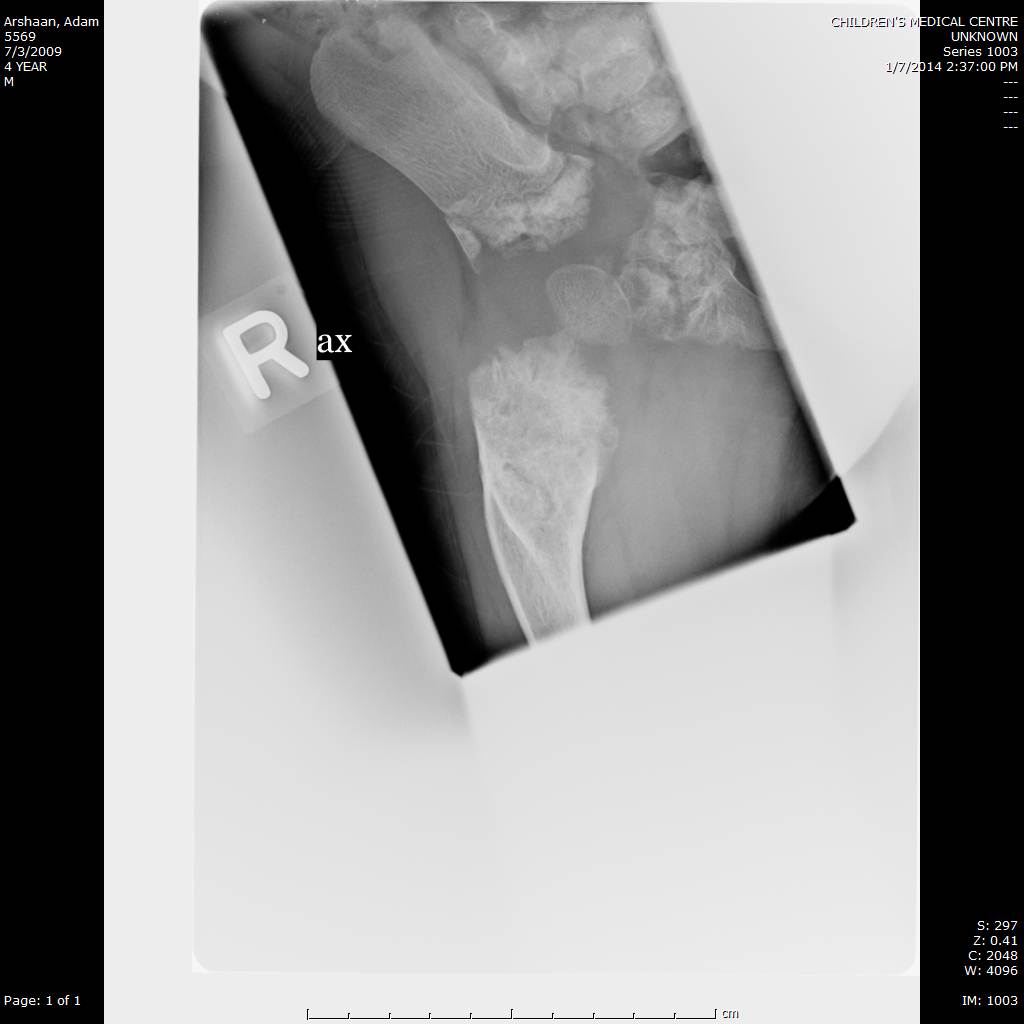 Clinical photo of patient