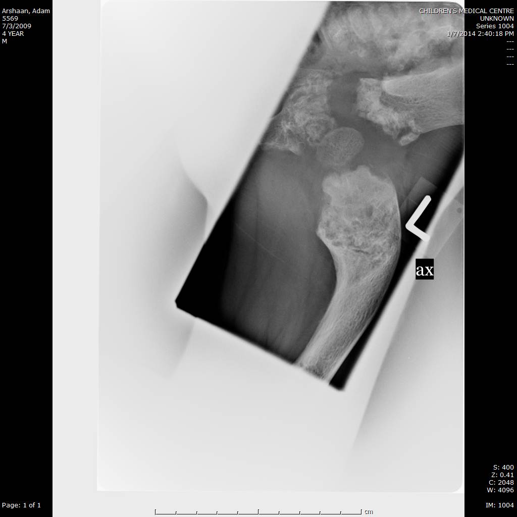Clinical photo of patient